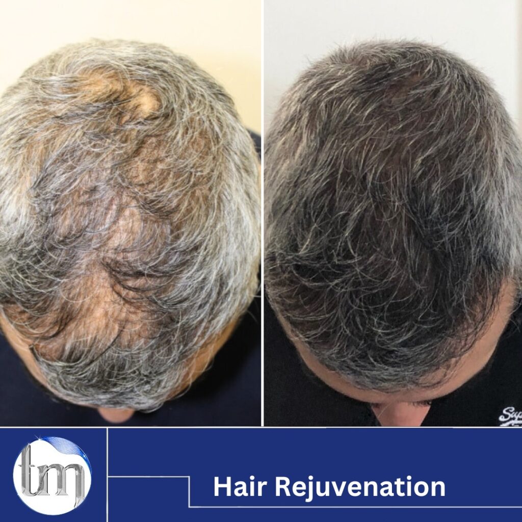 hair rejuvenation